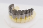 FCC 3Dの歯科プリンター二重繊維レーザー デジタル20-60μMの王冠および総義歯3Dプリンター